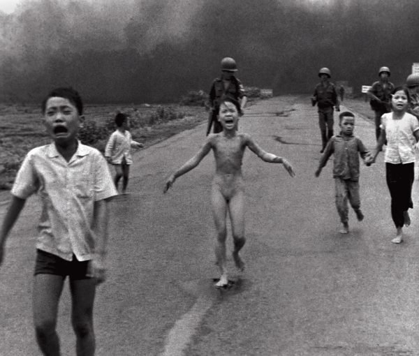 Vietnam War ‘Napalm Girl’ Undergoes Laser Treatment (Video)