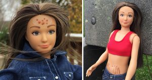 Lammily Doll with Acne & Cellulite additions