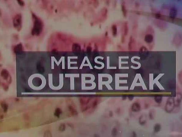 Minnesota Dealing Major Measles Outbreak Due To Immigration And Quran [VIDEO]